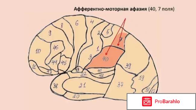 Афазия у человека: причины, виды, лечение 