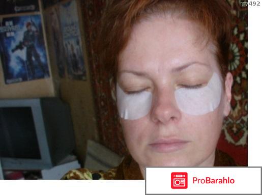 Лифтинг кожи вокруг глаз дома отрицательные отзывы