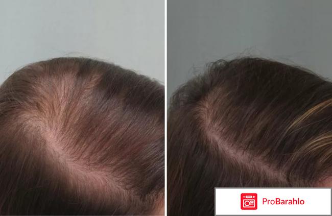 Регейн обман