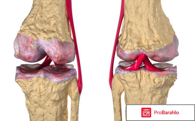 Сусталайф (Sustalife) отзывы владельцев
