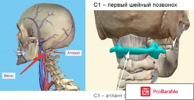 Свобода атланта илья бурлаковский отрицательные отзывы отрицательные отзывы