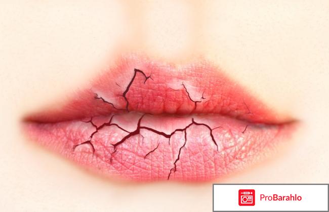 Уход за губами отрицательные отзывы