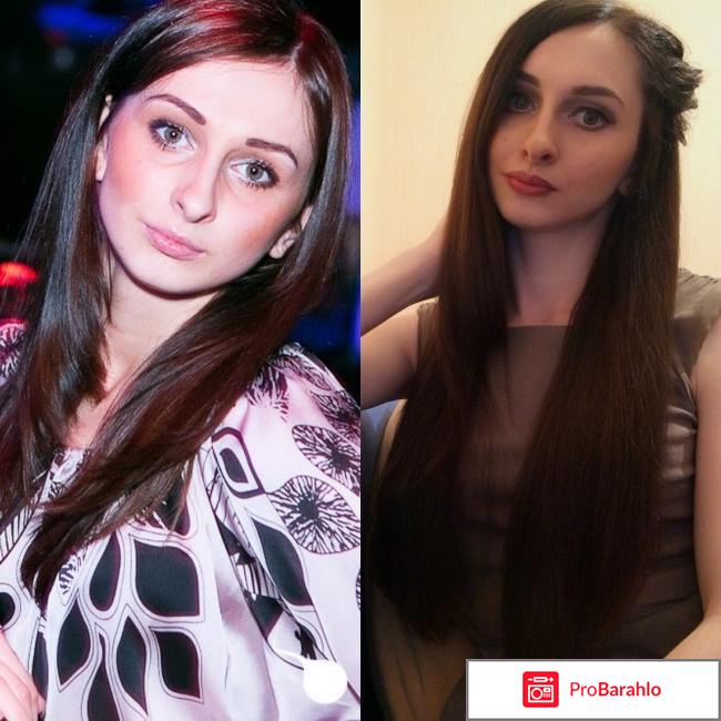 Касторовое масло 