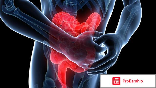 Сульфасалазин отрицательные отзывы