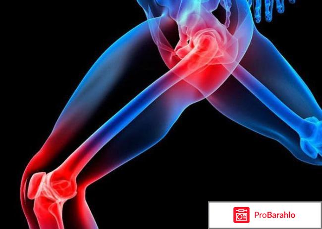 Сустафаст для суставов купить в аптеке СПБ отрицательные отзывы