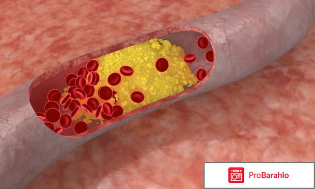 Симвастатин инструкция по применению цена отзывы отрицательные отзывы