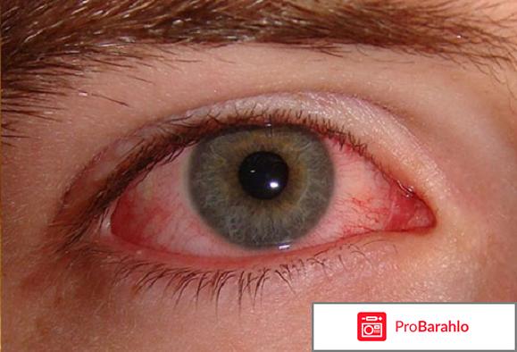 Ннпцто отзывы о продукции отрицательные 