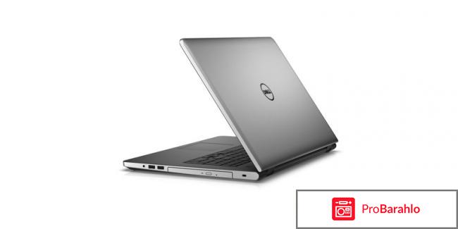 Dell XPS 15, Silver Black (9550-7920) отрицательные отзывы