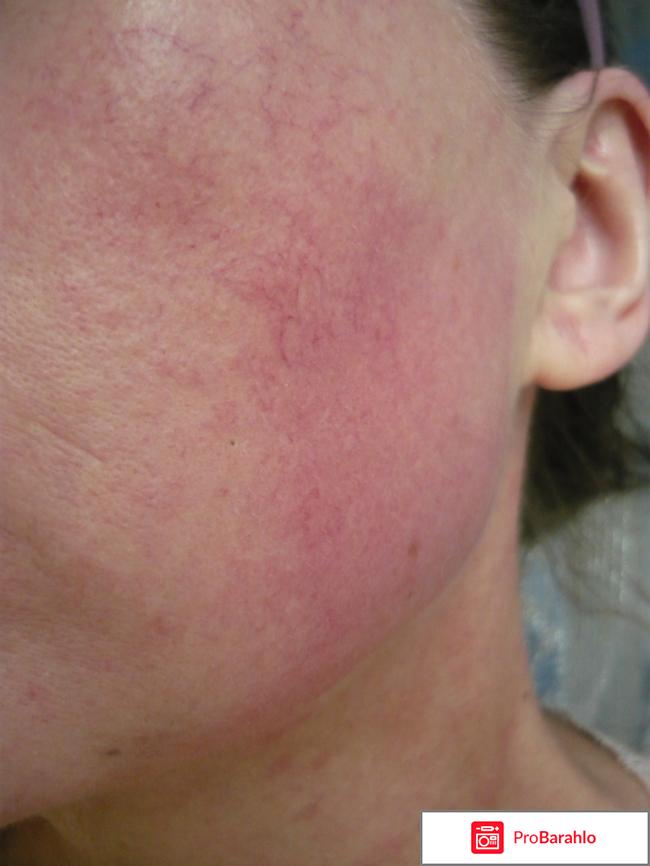 Пантенол крем EVO фото