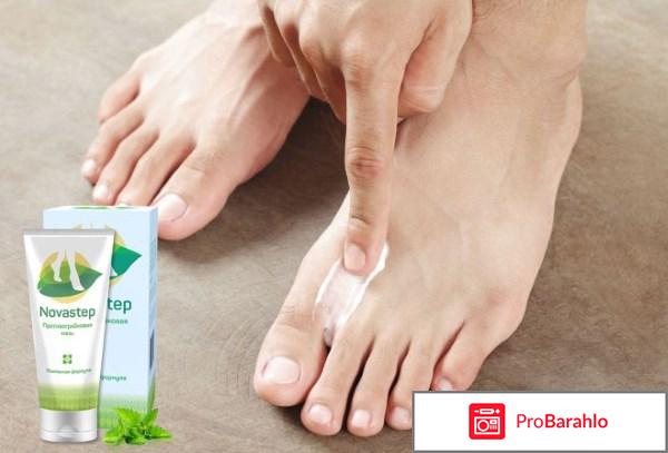 Новастеп мазь реальные отзывы форум отрицательные отзывы