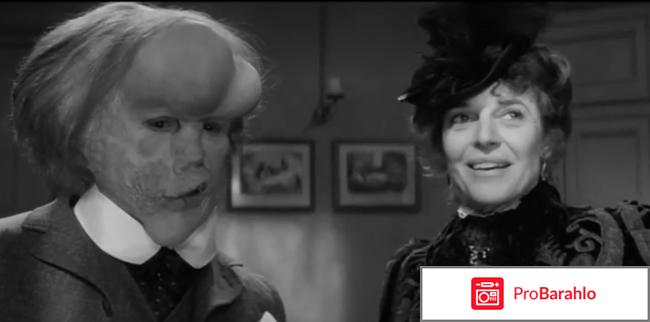 Фильм человек слон отзывы отрицательные отзывы