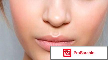 Мазь траумель обман