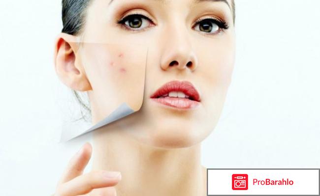 Иганержинг 