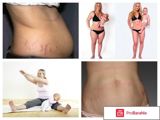 Как убрать живот после родов - комплексный подход отрицательные отзывы