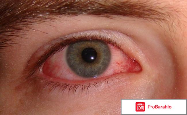 Флоксал глазные капли инструкция цена аналоги отзывы отрицательные отзывы