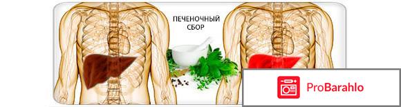 Печеночный сбор для очистки печени 