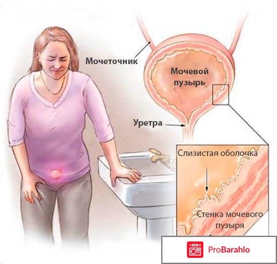 Монурал цена 2018 обман