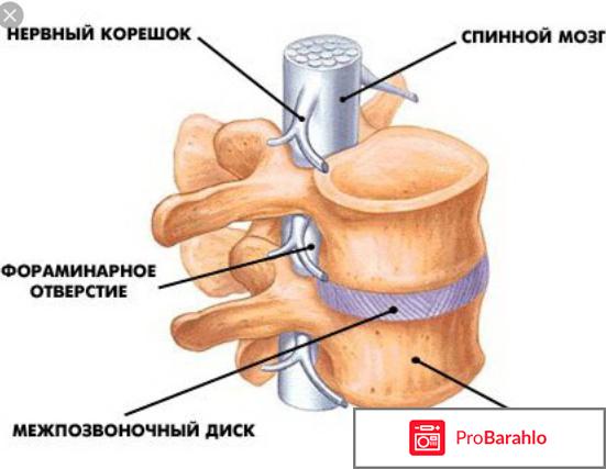 Парез конечностей 