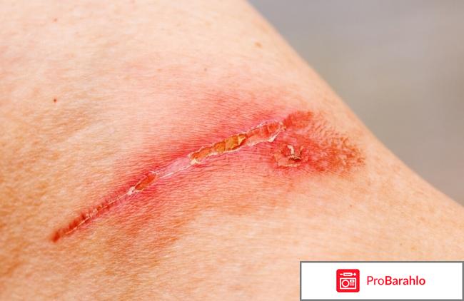 Стелланин инструкция по применению цена отзывы отрицательные отзывы