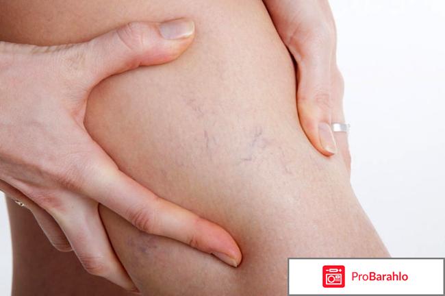 Флебодиа 600 инструкция по применению цена аналоги отрицательные отзывы