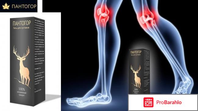 Пантогор для суставов: цена, отзывы, купить гель отрицательные отзывы
