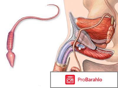 Олигоспермия отрицательные отзывы