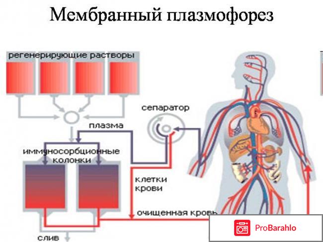 Плазмофорез отрицательные отзывы