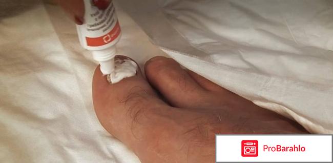 Крем-паста для ногтей «Микостоп» Фармтек обман