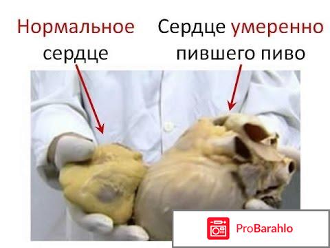 Алкопрост реальные отзывы