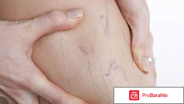 Варикобустер в аптеке 