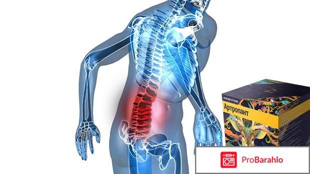 Артропант (Artropant) фото