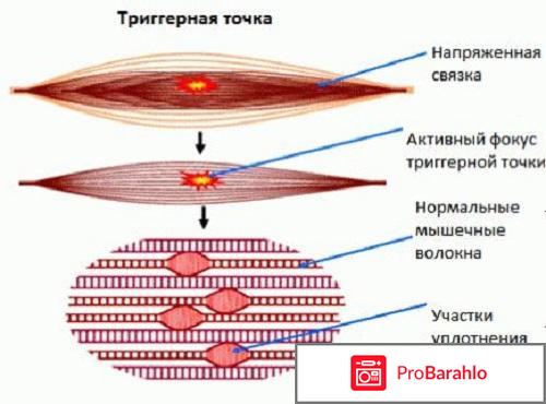 Массажер Колдаева реальные отзывы