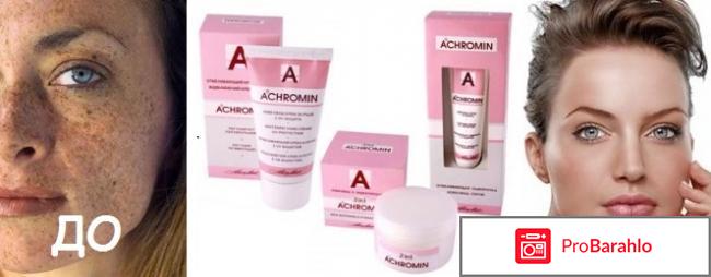 Крем ахромин от пигментных пятен обман