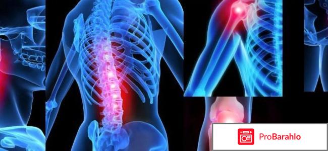 Артодекс обман