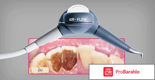 Чистка зубов методом air flow обман