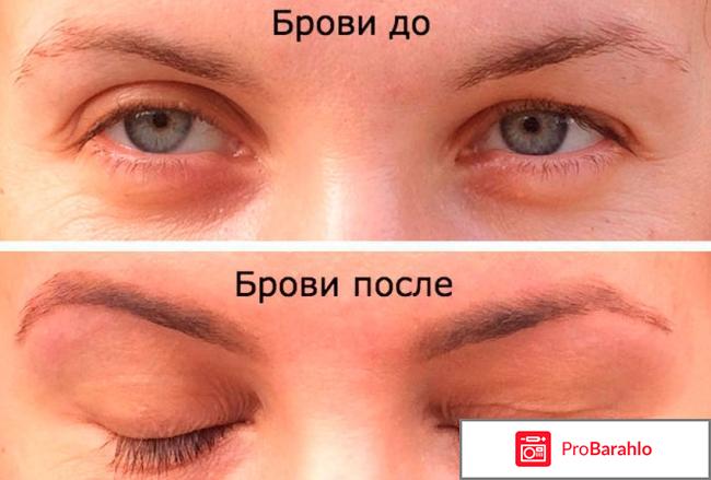 Касторовое масло для ресниц и бровей отрицательные отзывы