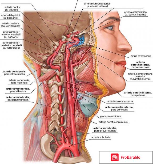 Гипоплазия позвоночной артерии реальные отзывы