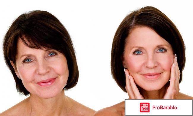 Ботокс для лица купить обман