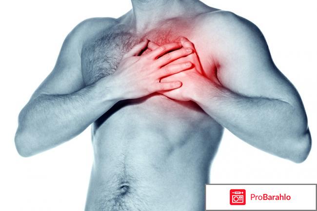 Аспаркам авексима 