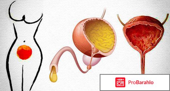 Лечение цистита у женщин отзывы форум обман