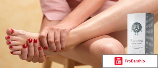 Варанга от грибка ногтей отзывы цена отрицательные отзывы