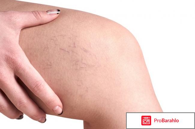 Lifestream Nano: отзывы врачей и людей 