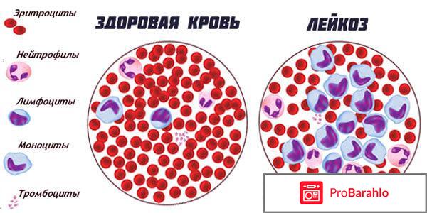 Полицитемия — симптомы, причины и лечение отрицательные отзывы