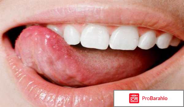 Неровный язык по краям обман