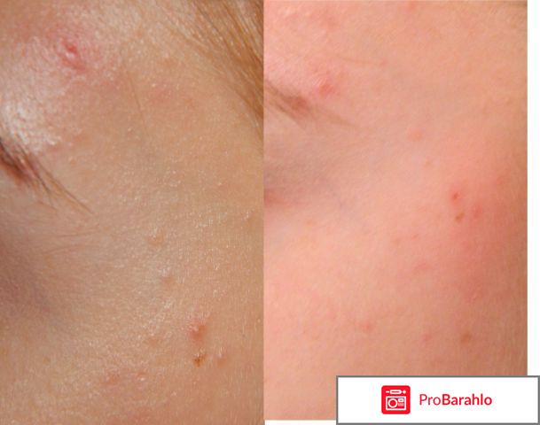 Авен Эмульсия увлажняющая матирующая