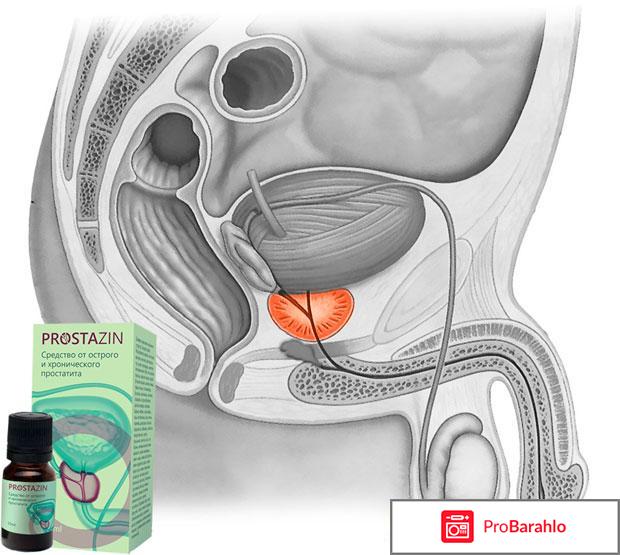 Prostazin отрицательные отзывы