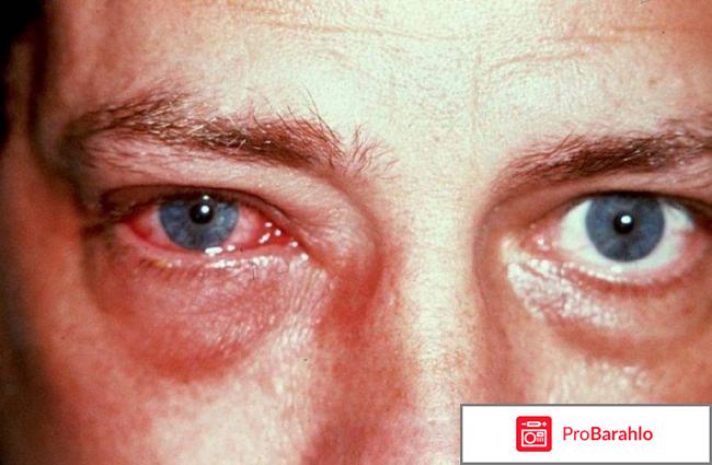 Опатанол отзывы отрицательные отзывы