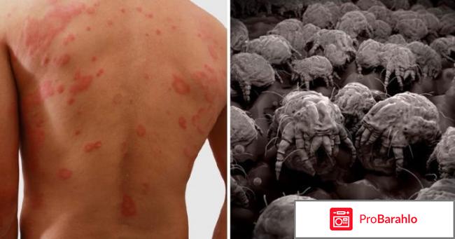 Клещи в постели отрицательные отзывы