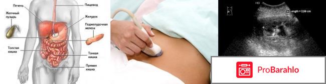 Что такое узи жкт и как его делают 