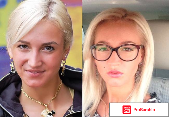 Как Ольга Бузова похудела, фото до и после похудения 